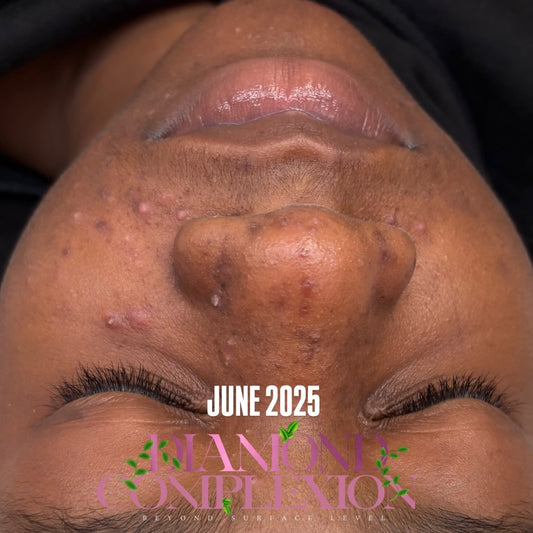 Clientine Enrollment